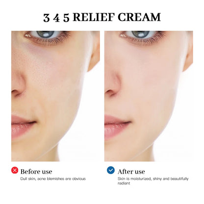 Before and after comparison of skin with '3 4 5 Relief Cream' showing improved skin texture.